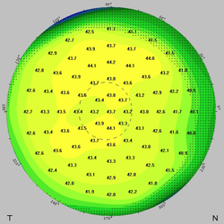 Topographie einer normalen Hornhaut